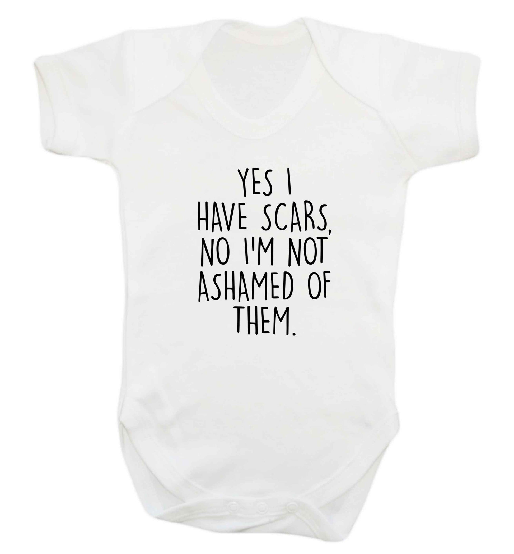 Yes I have scars, no I'm not ashamed of them baby vest white 18-24 months